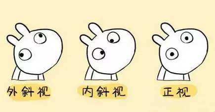 成人斜视怎么办？西宁爱尔李巧玲医生提醒：治斜视永远都不太晚(图1)