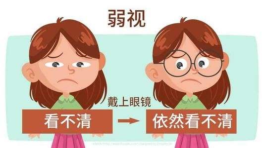 西宁爱尔眼科医院：要想治孩子弱视，必须多了解弱视这几点必需知道(图1)